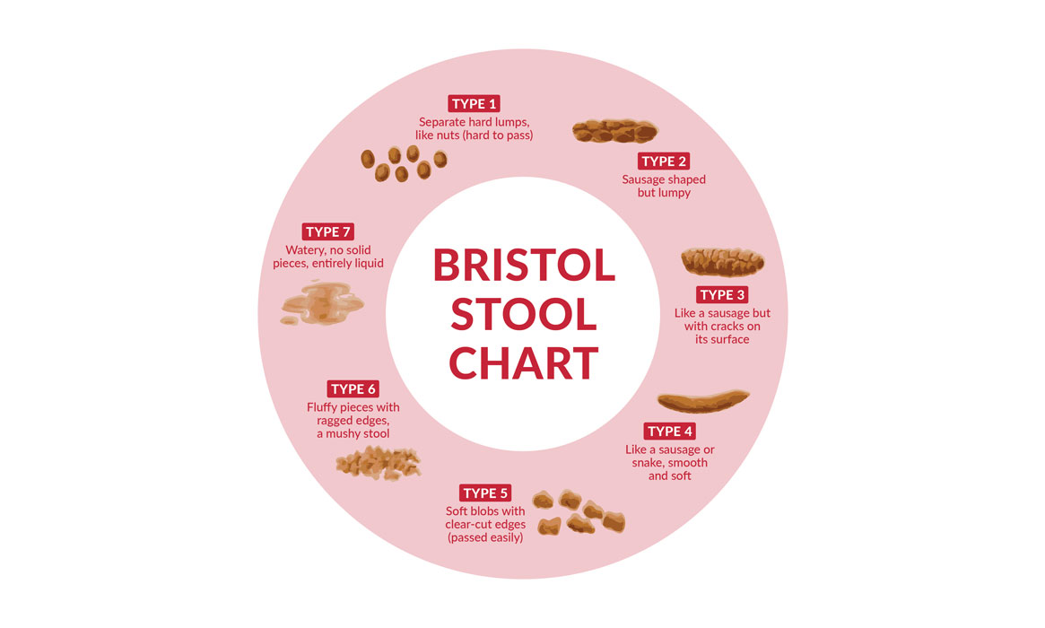 Bristol Stool Chart